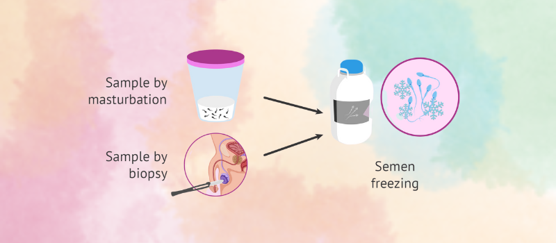 Fertility Preservation