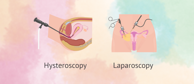 Hysteroscopy And Laparoscopy 