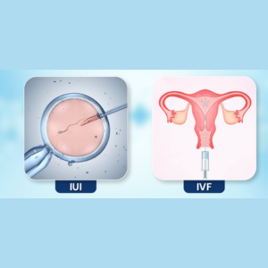 Difference Between IVF and IUI