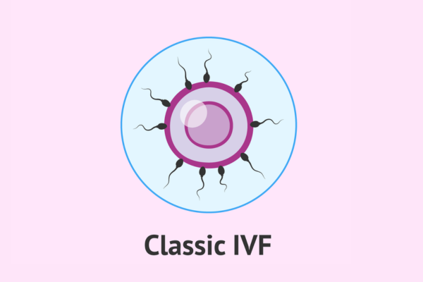 IVF Treatment