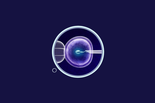 In Vitro Fertilisation
