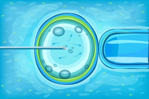 Calcium Ionophore Activation 