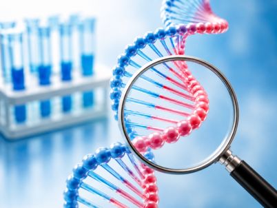 Sperm DNA Fragmentation Index (DFI) Test 
