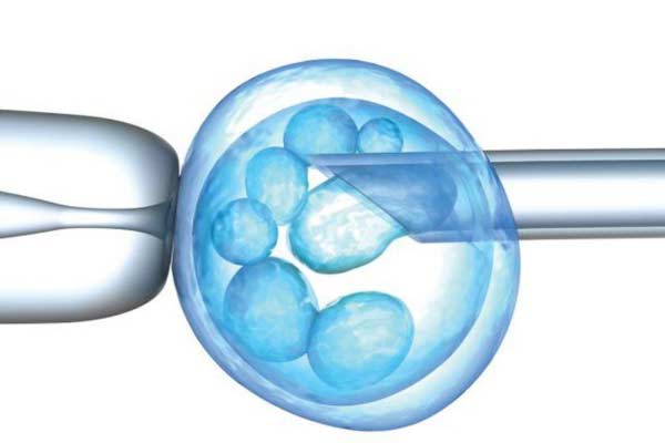 Embryo-Biopsy And Pre-Implantation Genetic Testing