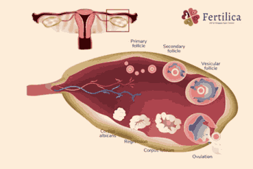 Ovulation Induction